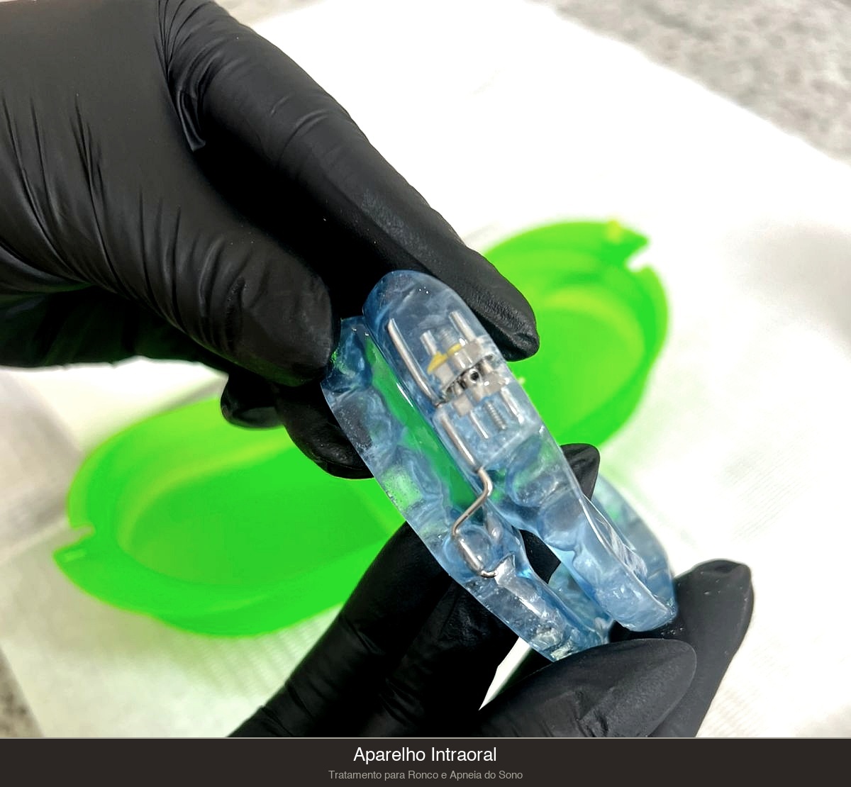 Aparelho Intraoral — Tratamento para Ronco e Apneia do Sono